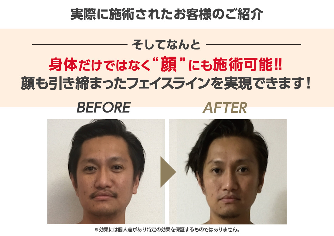 実際に施術されたお客様のご紹介