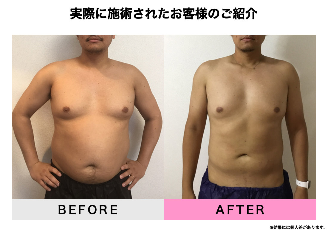 実際に施術されたお客様のご紹介