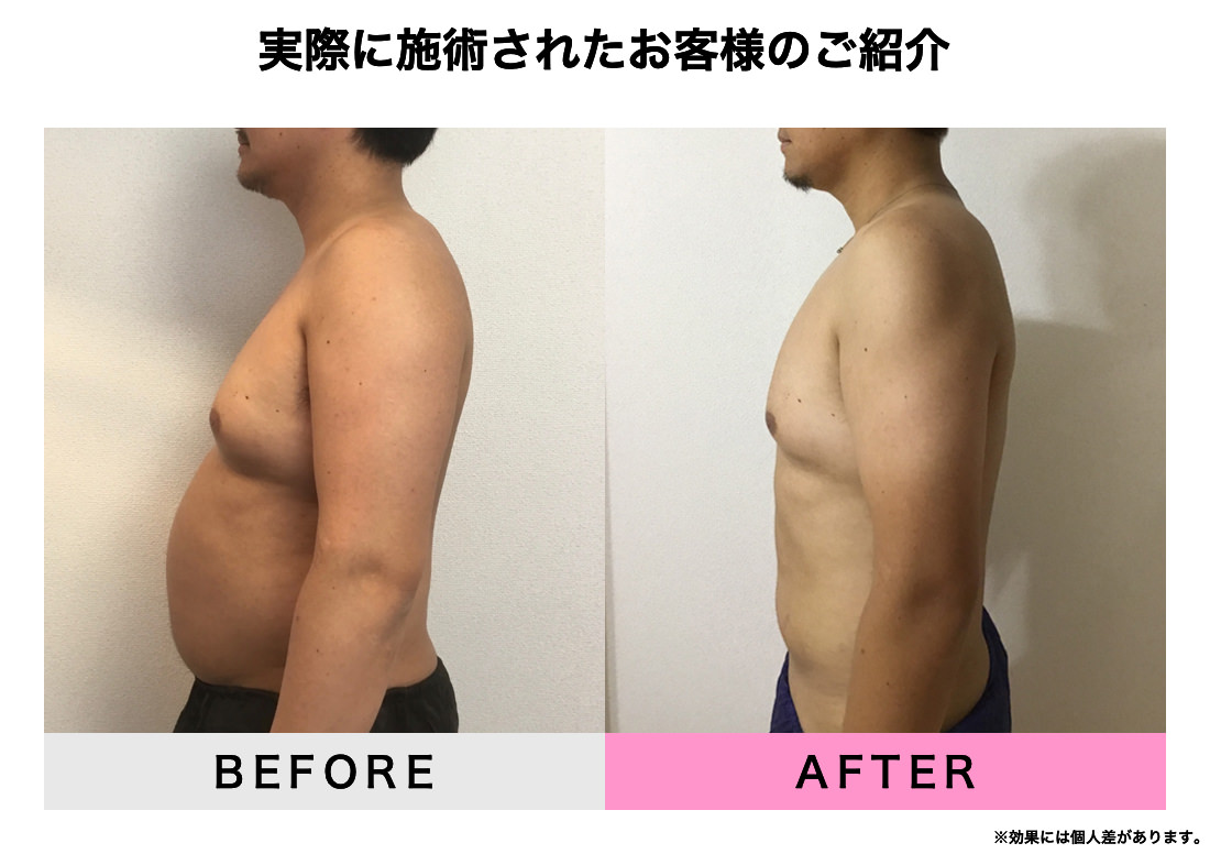 実際に施術されたお客様のご紹介