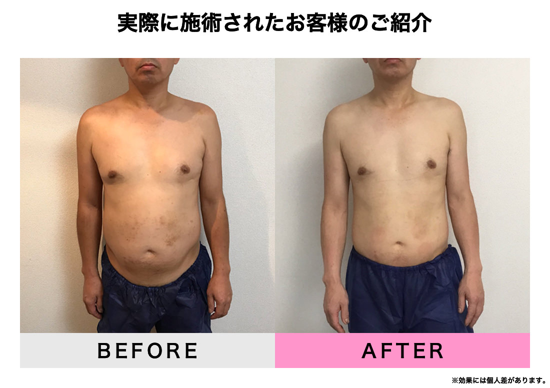 実際に施術されたお客様のご紹介