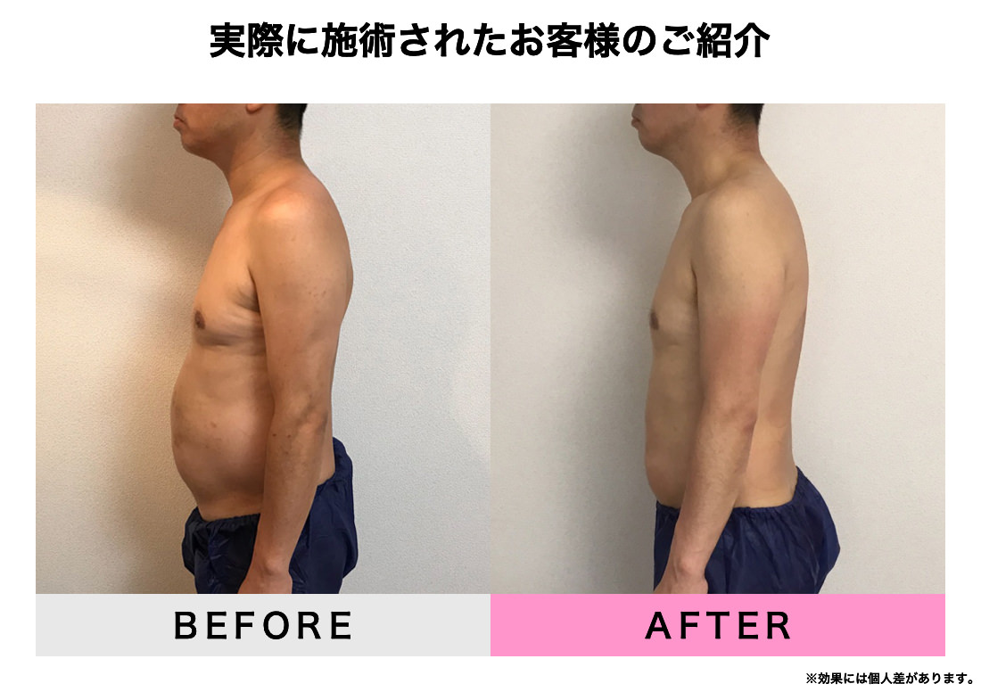 実際に施術されたお客様のご紹介