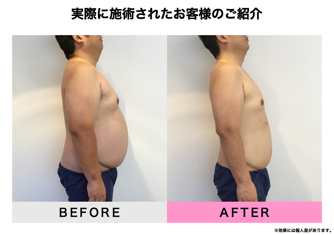 実際に施術されたお客様のご紹介