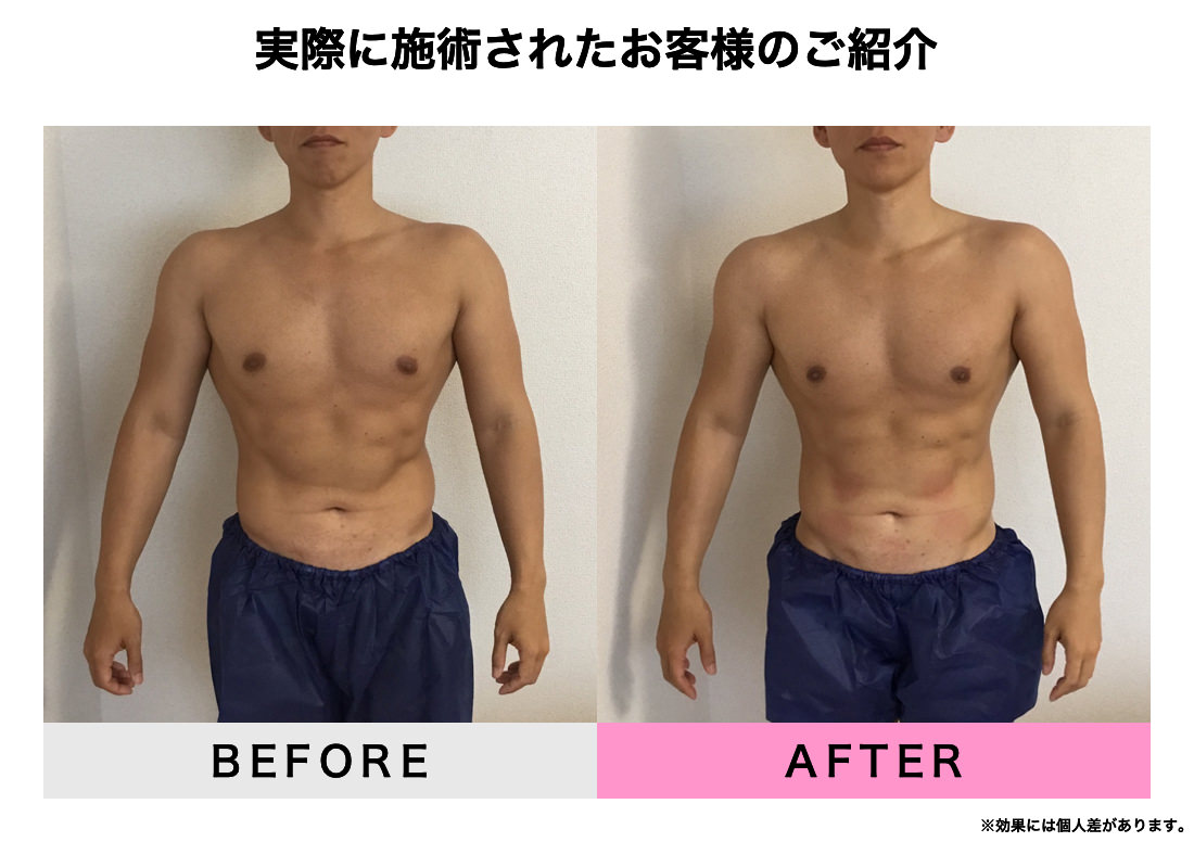実際に施術されたお客様のご紹介
