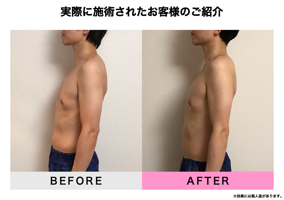 実際に施術されたお客様のご紹介