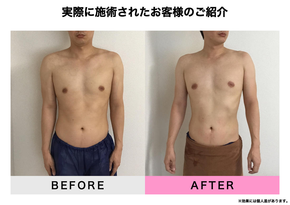 実際に施術されたお客様のご紹介