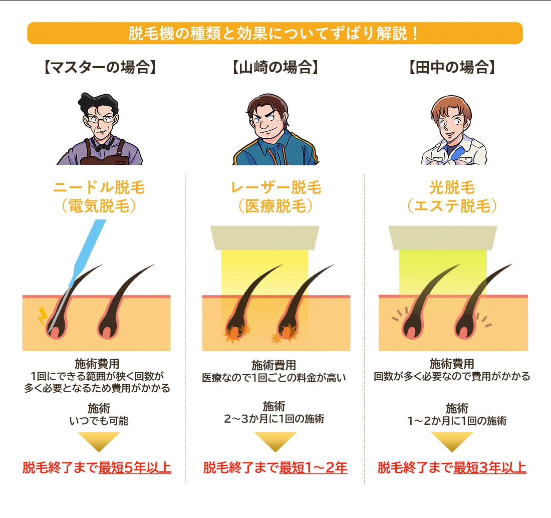 脱毛機の種類と効果についてズバリ解説