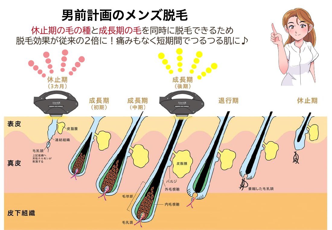 THE男前計画メンズ脱毛について