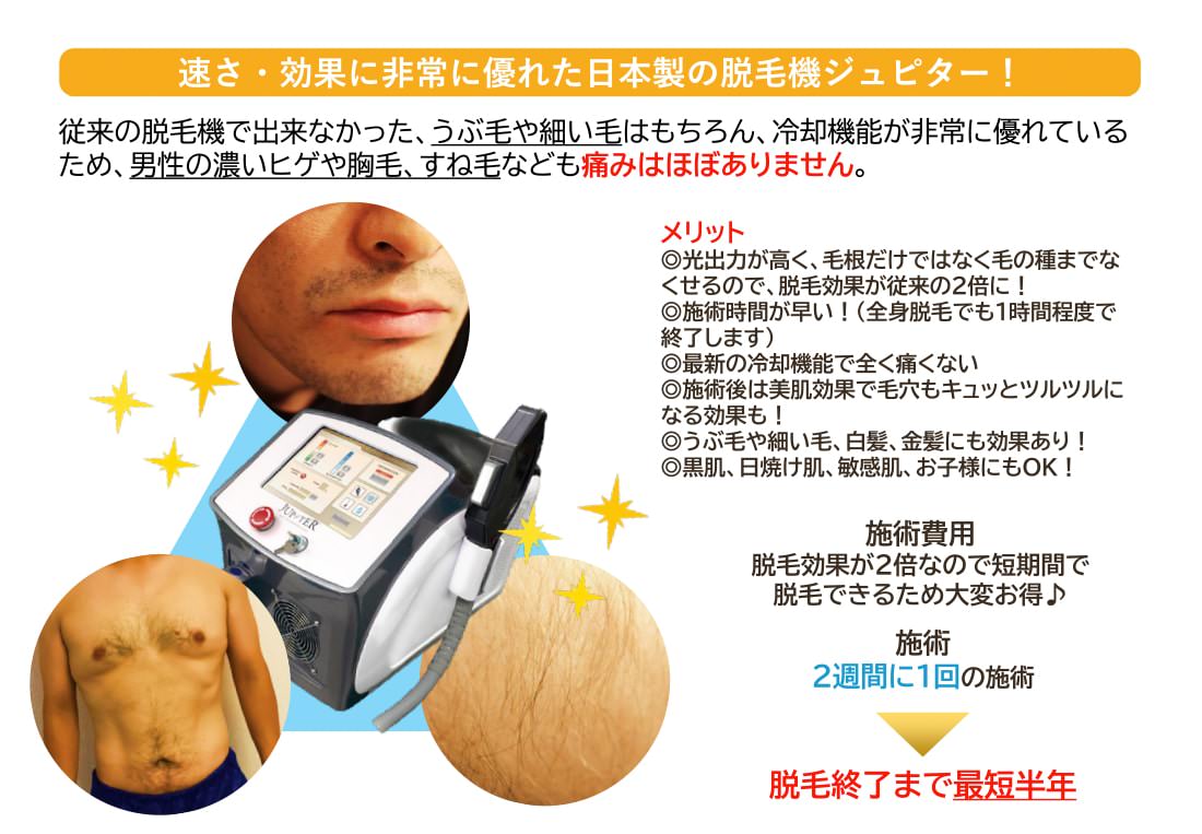 速さ・効果に非常に優れた日本製の脱毛器ジュピター